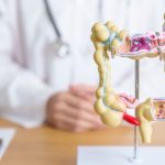 Câncer colorretal: por que a idade é o principal fator de risco e como se prevenir de forma eficaz