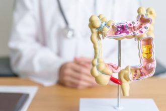 Câncer colorretal: por que a idade é o principal fator de risco e como se prevenir de forma eficaz