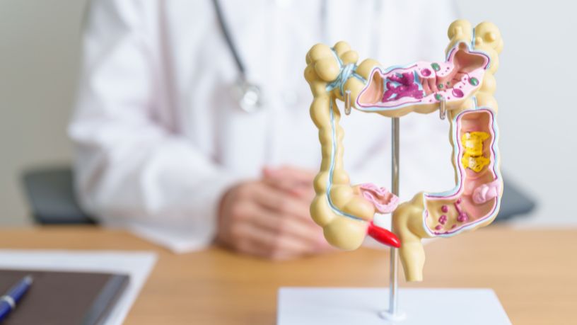 Câncer colorretal: por que a idade é o principal fator de risco e como se prevenir de forma eficaz